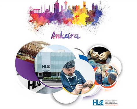 ankara workshop
